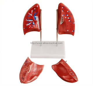 Lung Model
