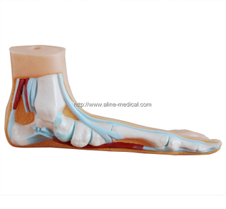 Flat Foot