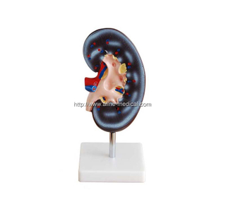 Kidney Model (1 Part)