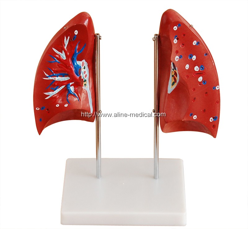 Lung Model