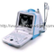 Portable Ultrasound System