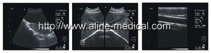 Portable ultrasound scanner