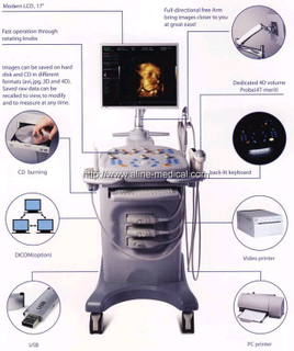 ULTRASOUND SYSTEM