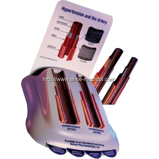 Hypertension model