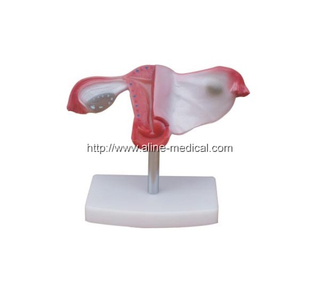 Natural Uterus Model